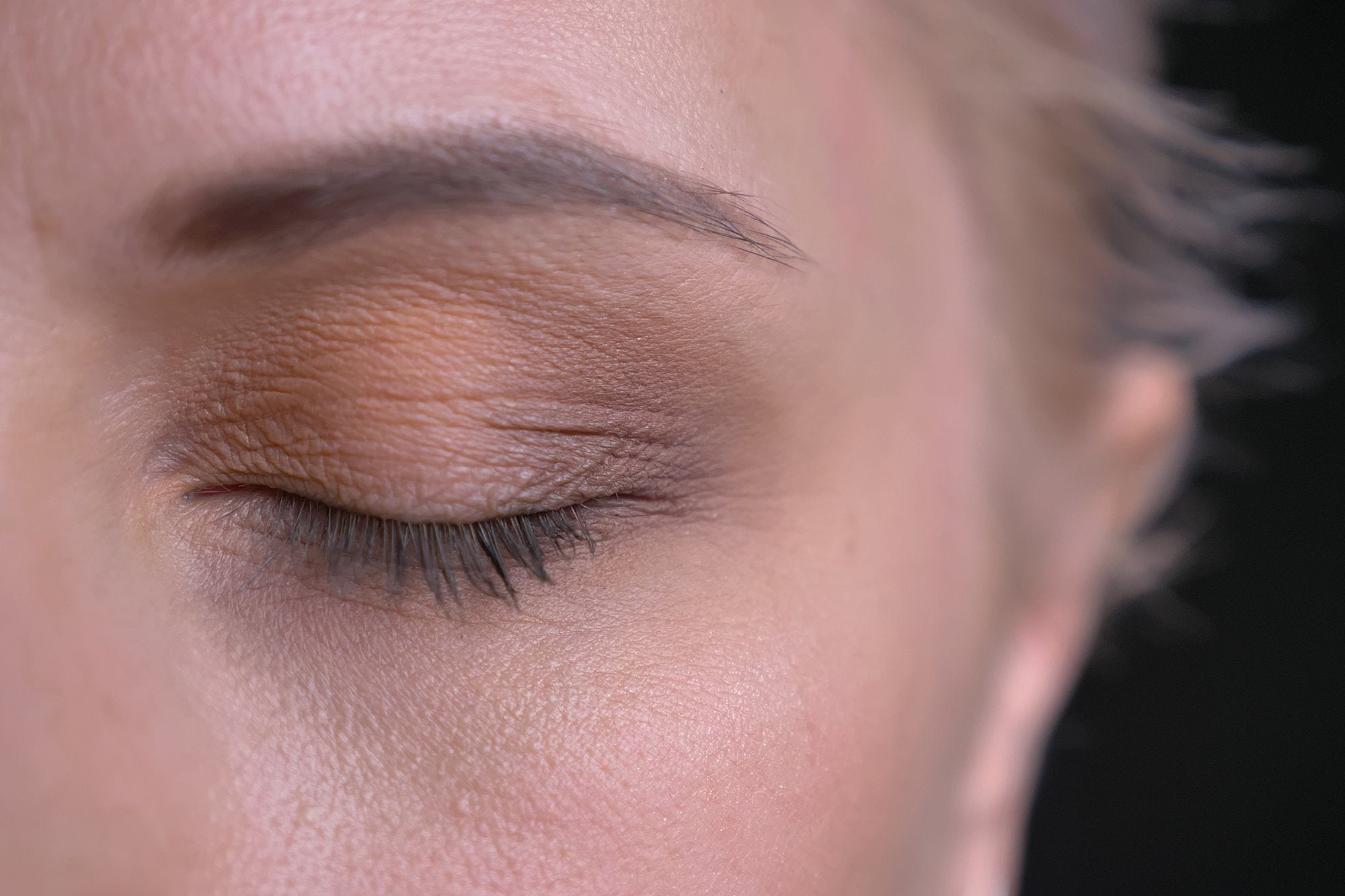 When to Worry About Eye Twitching