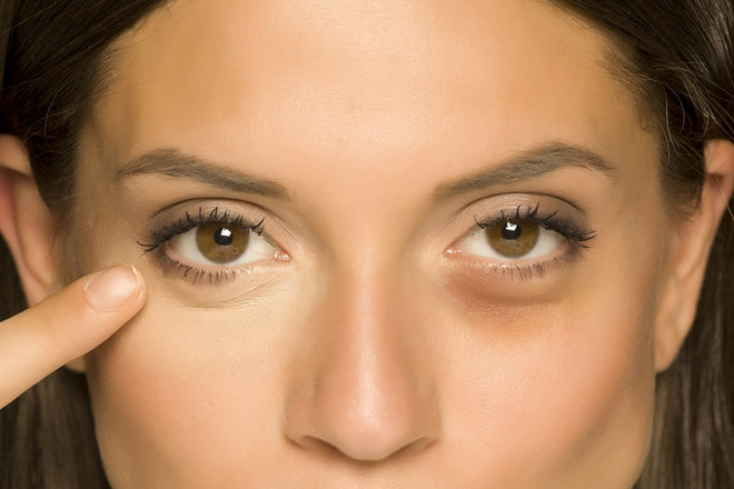 How to Get Rid of Bags Under Eyes